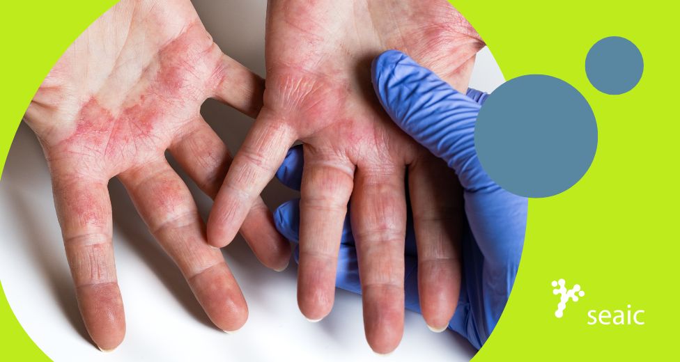 Advertencias SEAIC bajada de temperaturas