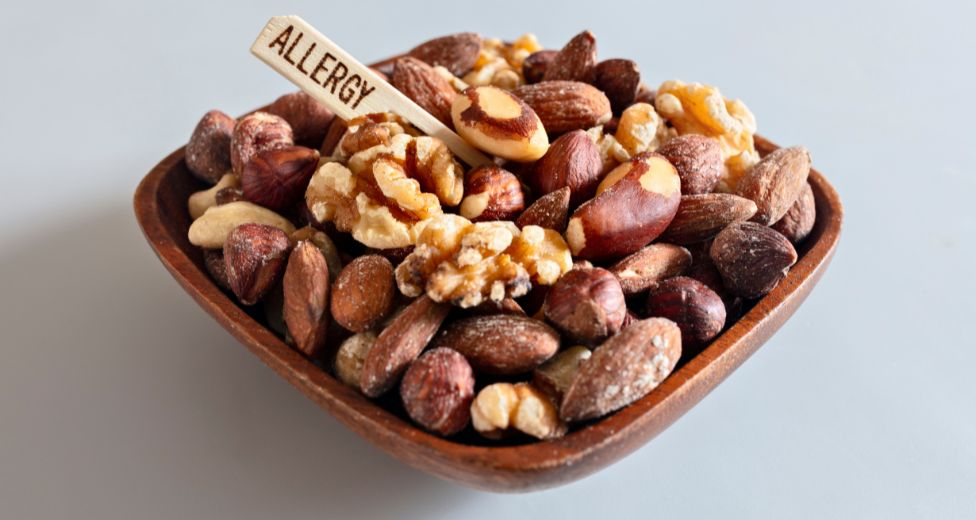 Alergia a frutos secos SEAIC